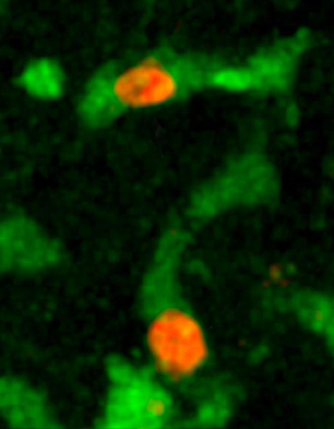 Capture de lymphocytes B cancéreux (en orange) dans le foie par des cellules de Kupffer (en vert). © Institut Pasteur, P. Bousso