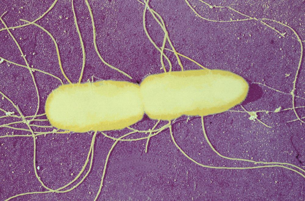 Santé Publique - CCOMS - Salmonella - Institut Pasteur