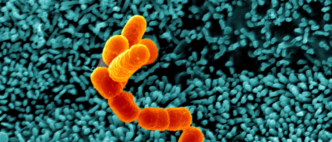 Escherichia coli, Shigella, Salmonella - Institut Pasteur