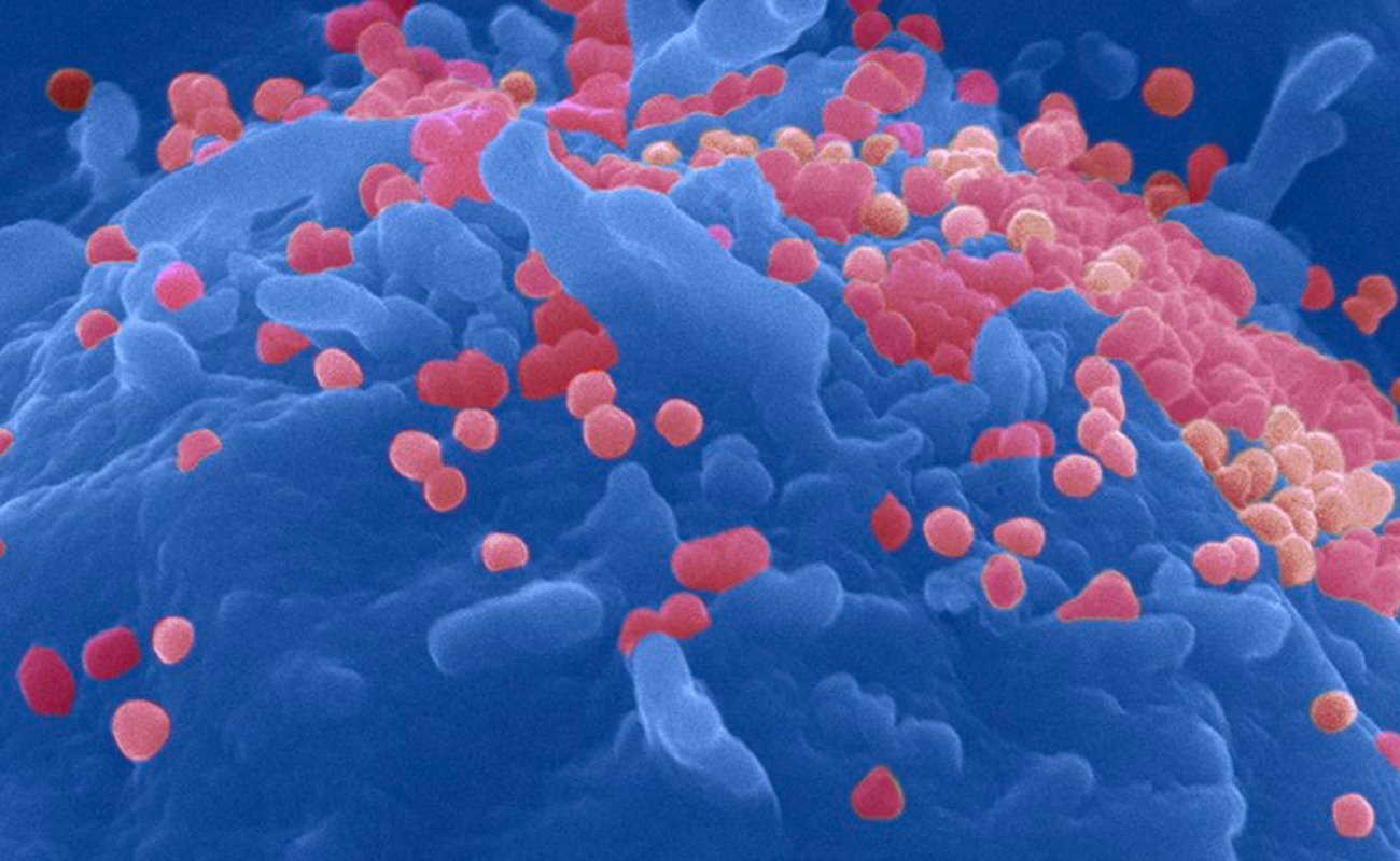 Particules du virus du Sida (VIH) bourgeonnant à la surface d'un lymphocyte T CD4 - Institut Pasteur