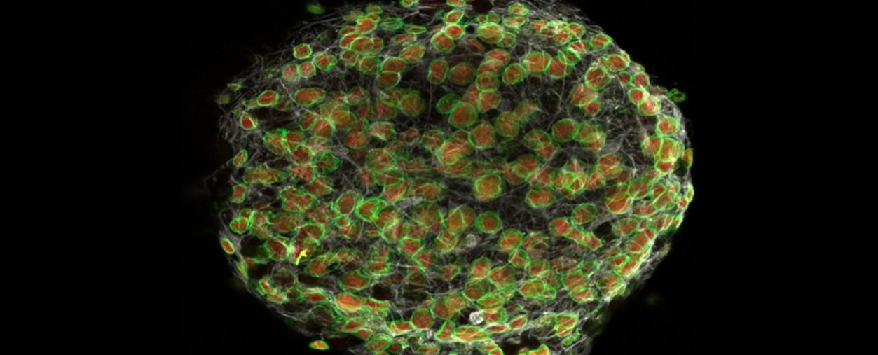 Petit groupe de cellules souches nerveuses isolées chez la souris et cultivées in vitro observées au microscope confocal
