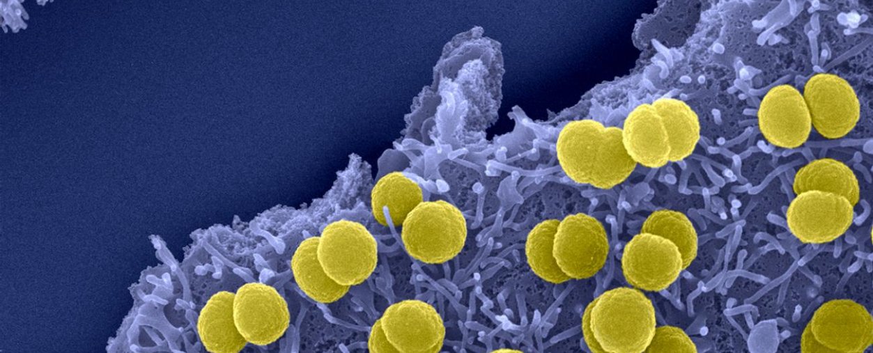 Méningites à méningocoques - Institut Pasteur