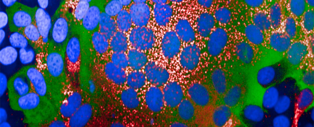 Les variants Alpha, Bêta et Delta de SARS-CoV-2 possèdent des propriétés de fusion virale augmentée par rapport aux souches plus anciennes