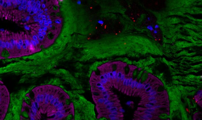 Coupe d’intestin humain représentant le microbiote intestinal