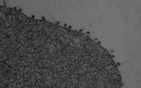 Image de microscopie électronique montrant l’accumulation de particules virales à la surface de cellules dérivées d’un cerveau de chauve-souris