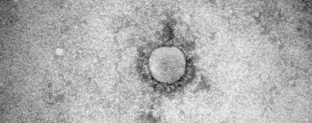 Coronavirus et hépatite Coronavirus et hépatite