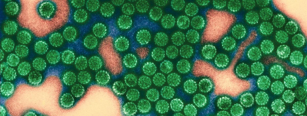 Porteur sain du papillomavirus - Hpv chez l homme porteur sain