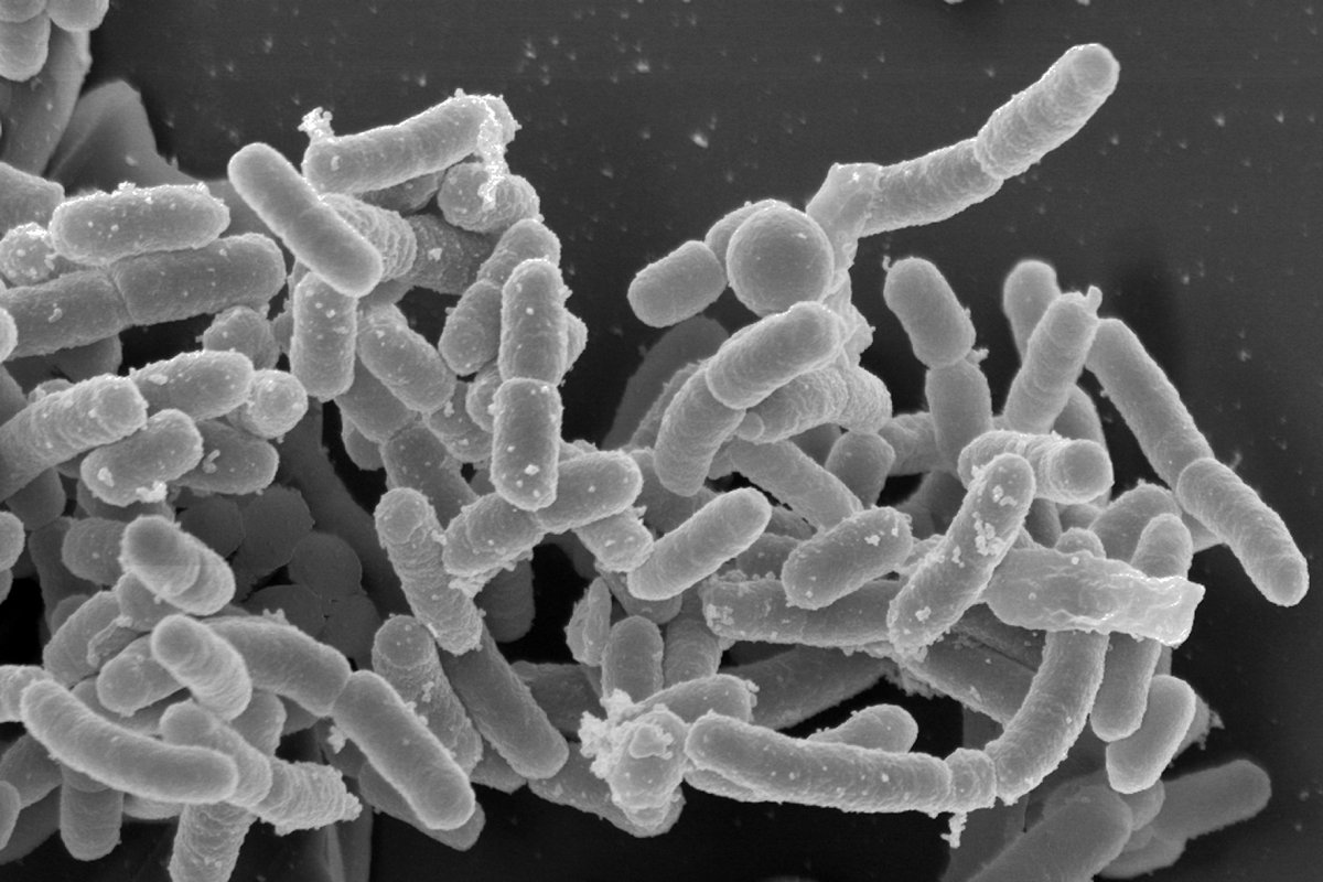 Yersinia pestis maladie