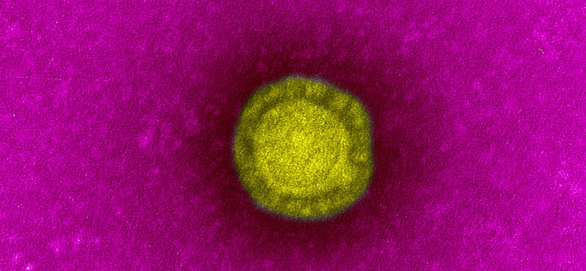 Covid 19 Disease Novel Coronavirus Institut Pasteur