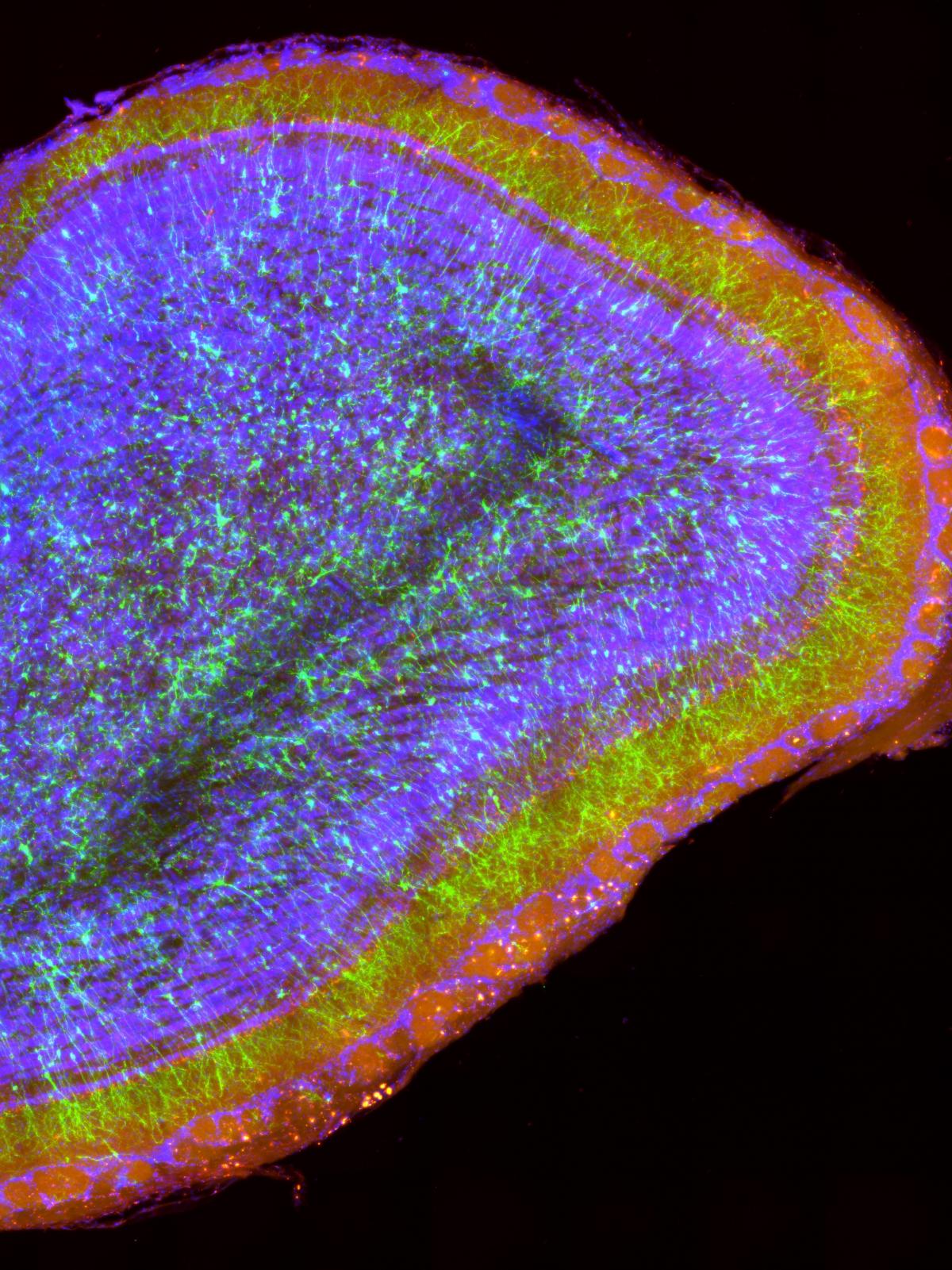 New neurons in the adult brain are involved in sensory learning - Press release Institut Pasteur