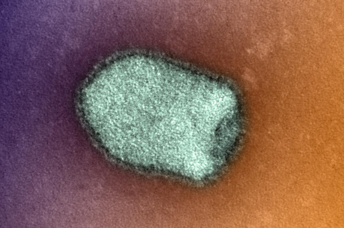 Two major types of rabies that evolved in different ways | Institut Pasteur