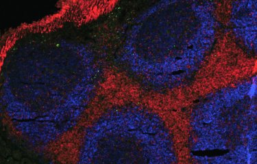 Plaques de Peyer vues du dessus. Il s'agit d'une population de lymphocytes qui "veillent "sur l'intestin