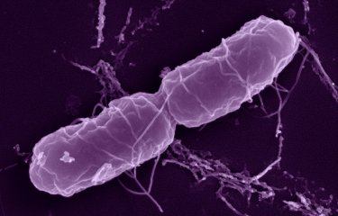 Bactérie Salmonella enterica en microscopie à balayage.