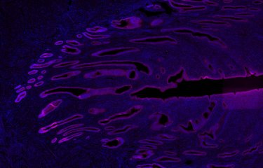 Image en immunofluorescence d'une coupe d'endomètre marquant les cellules épithéliales (magenta) et les noyaux des cellules (bleu).