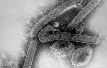 Image de microscopie électronique à transmission révélant une partie de la morphologie ultrastructurale présentée par un certain nombre de virions du virus Marburg