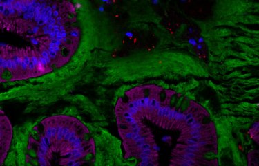 Coupe d’intestin humain représentant le microbiote intestinal