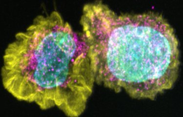 Virus de la rougeole perturbant le réseau mitochondrial et le métabolisme cellulaire