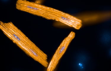cardiomyocytes de souris en orange, mitochondries en bleu