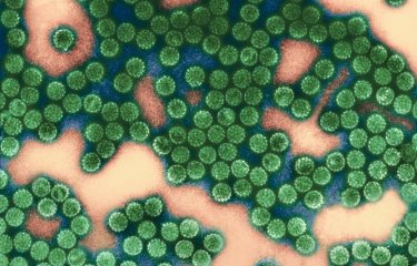 5 raisons de suivre le MOOC "Viruses and Human Cancer"