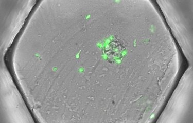 microfluidique copyright Institut Pasteur