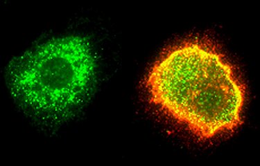 Macrophage humain infecté par le virus Lassa (Arénavirus)