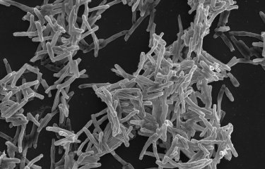 Mycobacterium tuberculosis, agent de la tuberculose. Microscopie electronique à balayage.