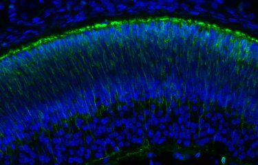 Coloration d'un oeil embryonnaire de souris - Institut Pasteur