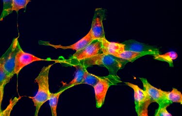 Détection du virus Chikungunya dans des cellules Véro en culture en microscopie à fluorescence - Institut Pasteur
