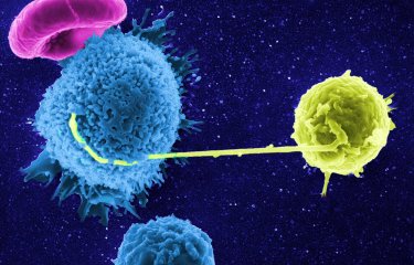 Contact entre un lymphocyte infecté par le VIH (en jaune) avec un lymphocyte non-infecté ©  Institut Pasteur/Stéphanie Guadagnini et Marie-Christine Prévost