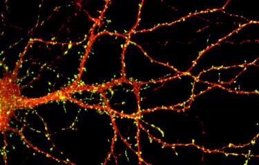 Neurone - Institut Pasteur