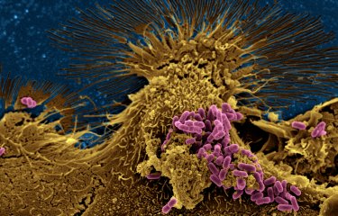 Bactéries Escherichia coli en interaction avec des cellules de l'épithélium intestinal humain © Institut Pasteur