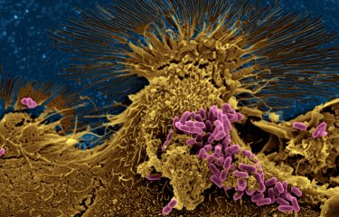 Bactéries Escherichia coli ©  Institut Pasteur/Chantal Le Bouguénec