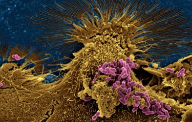 Bactéries Escherichia coli en interaction avec des cellules de l'épithélium intestinal humain