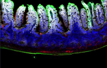 Toxine botulique dans intestin de souris 