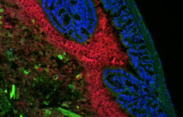 	Colon murin dont le noyau des cellules est marqué en bleu, les cellules elles-mêmes en vert, et les bactéries en rouge (par coloration de leur ARN ribosomique). Des débris d'aliments sont également visibles en vert dans la lumière intestinale