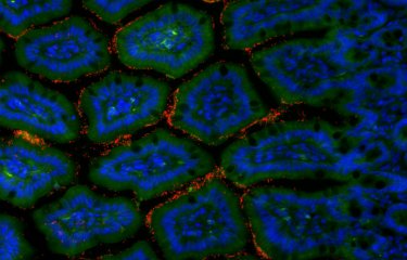 Cellules de l'intestin grêle murin et bactéries - Institut Pasteur