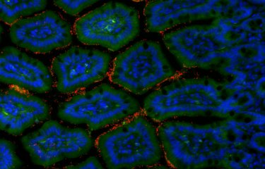 Cellules de l'intestin grêle murin et bactéries