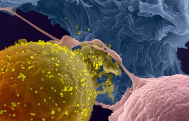 La transmission du VIH-1 de cellule à cellule © Institut Pasteur