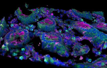 Coloration de la cytokine dans un intestin de singe vert d'Afrique - Institut Pasteur