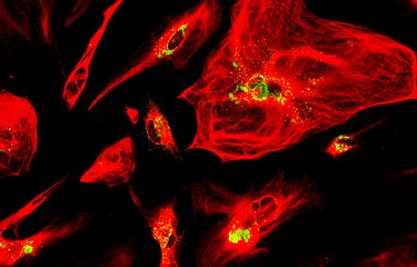 Astrocytes infectées avec le virus de la rage - Institut Pasteur