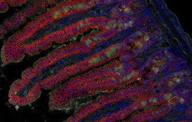  Imagerie en fluorescence de villosités intestinales après infection par Listeria monocytogenes ©  Institut Pasteur