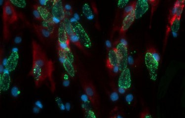 Cellules humaines infectées par Chlamydia trachomatis © Institut Pasteur/Sébastien Triboulet et Agathe Subtil