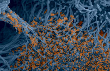 Cellules bronchiques humaines infectées par SARS-CoV-2 © Institut Pasteur