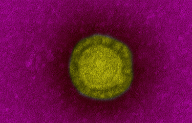Fiche Maladie - Coronavirus de Wuhan - Institut Pasteur