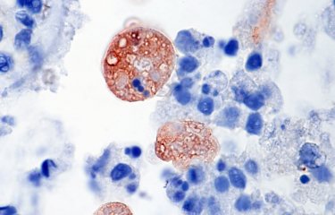 Entamoeba histolytica - Institut Pasteur