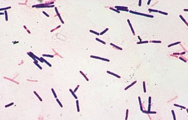 Fiche Maladie - Botulisme - Institut Pasteur