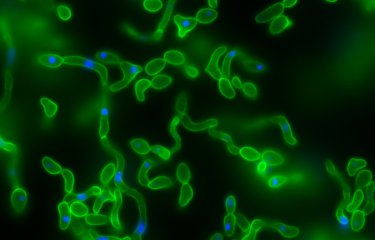 Fiches maladies - Candidoses - Institut Pasteur