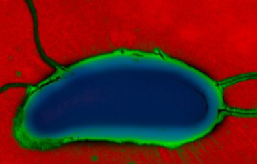 Fiches maladies - Choléra - Institut Pasteur