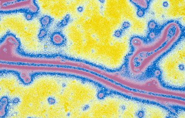Fiches maladies - Ebola - Institut Pasteur