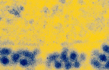 Fiches maladies - Fièvre jaune - Institut Pasteur